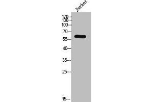 Western Blot analysis of JK cells using AR-α1B Polyclonal Antibody (ADRA1B antibody  (C-Term))