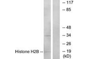 Western blot analysis of extracts from A549 cells, using Histone H2B Antibody. (Histone H2B antibody  (AA 1-50))