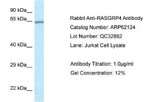Western Blotting (WB) image for anti-RAS Guanyl Releasing Protein 4 (RASGRP4) (N-Term) antibody (ABIN2789029) (RASGRP4 antibody  (N-Term))