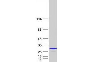 Validation with Western Blot