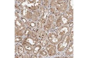 Immunohistochemical staining of human kidney with LEMD3 polyclonal antibody  shows nuclear positivity often accentuated to the membrane in renal tubules. (LEMD3 antibody)