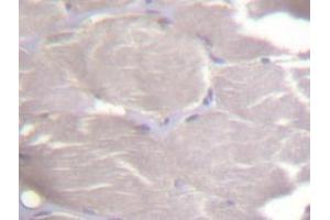 Immunohistochemistry (IHC) analyzes of IKKα/β antibody in paraffin-embedded human skeletal muscle tissue. (IKK alpha antibody)