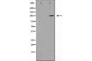 Western blot analysis of extracts from Jurkat cells using CDH17 antibody. (LI Cadherin antibody  (Internal Region))