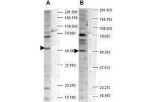 Western blot analysis is shown using SH3BP2 (phospho S427) polyclonal antibody  to detect endogenous protein present in unstimulated human whole cell lysates. (SH3BP2 antibody  (pSer427))