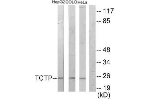 Western Blotting (WB) image for anti-Tumor Protein, Translationally-Controlled 1 (TPT1) (Internal Region) antibody (ABIN1849166) (TPT1 antibody  (Internal Region))