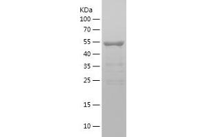 Western Blotting (WB) image for Dedicator of Cytokinesis 6 (DOCK6) (AA 1718-1971) protein (His-IF2DI Tag) (ABIN7282654) (DOCK6 Protein (AA 1718-1971) (His-IF2DI Tag))