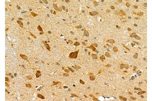 ABIN6257607 and ABIN6275769 at 1/100 staining Rat brain tissue by IHC-P. (IL11RA antibody  (C-Term))