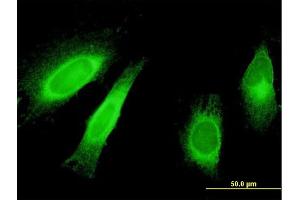 Immunofluorescence of monoclonal antibody to STAU1 on HeLa cell. (STAU1/Staufen antibody  (AA 401-496))