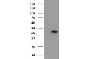 HEK293T cells were transfected with the pCMV6-ENTRY control (Left lane) or pCMV6-ENTRY ARG1 (Right lane) cDNA for 48 hrs and lysed. (Liver Arginase antibody)