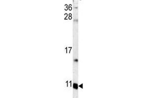 Western blot analysis of S100A6 antibody and mouse lung tissue lysate. (S100A6 antibody  (AA 37-67))