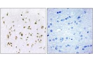 Immunohistochemistry analysis of paraffin-embedded human brain tissue, using HMG17 Antibody.