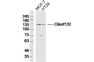Lane 1: MCF-7 lysates Lane 2: HT29 lysates probed with C6orf132 Polyclonal Antibody, Unconjugated  at 1:300 dilution and 4˚C overnight incubation. (C6ORF132 antibody  (AA 1001-1188))