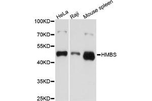 Western blot analysis of extracts of various cell lines, using HMBS antibody. (HMBS antibody)