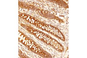 Immunohistochemical analysis of (ABIN653144 and ABIN2842716) on paraffin-embedded human appendix tissue was performed on the Leica®BOND RXm. (FCGR1B antibody  (C-Term))