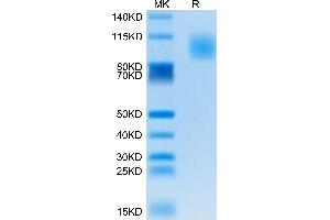 PODXL2 Protein (AA 33-500) (His tag)
