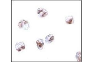 Immunocytochemistry of SCARA5 in HepG2 cells with SCARA5 antibody at 2. (SCARA5 antibody  (C-Term))