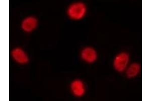 ABIN6275537 staining A549 by IF/ICC. (PRKX antibody  (Internal Region))