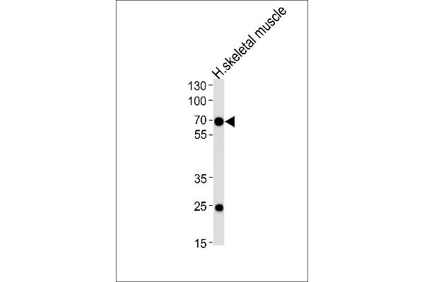 FAM198B antibody  (AA 275-304)