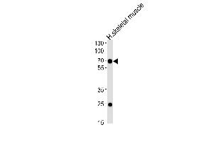 Western blot analysis of lysate from human skeletal muscle tissue lysate, using C4orf18 Antibody (Center) (ABIN657887 and ABIN2846841). (FAM198B antibody  (AA 275-304))