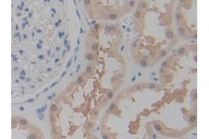 DAB staining on IHC-P; Samples: Human Kidney Tissue (P2RX7 antibody  (AA 47-334))