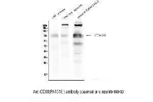 Anti-CD68 antibody, Western blotting Lane 1: Rat Spleen Tissue Lysate Lane 2: Mouse Spleen  Tissue Lysate Lane 3: Mouse RAW246. (CD68 antibody  (Middle Region))