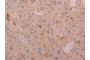 DAB staining on IHC-P; Samples: Human Liver Tissue (Cathepsin D antibody  (AA 23-161))