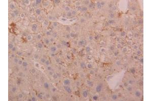 Immunohistochemistry (IHC) image for anti-Cathepsin D (CTSD) (AA 23-161) antibody (ABIN1174453)