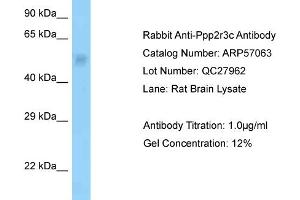 Western Blotting (WB) image for anti-Protein Phosphatase 2, Regulatory Subunit B'', gamma (PPP2R3C) (N-Term) antibody (ABIN2787044) (PPP2R3C antibody  (N-Term))