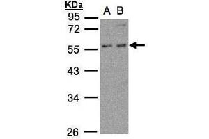 WB Image Sample (30μg whole cell lysate) A:MOLT4 , B:Raji , 10% SDS PAGE antibody diluted at 1:500 (PFKFB4 antibody)