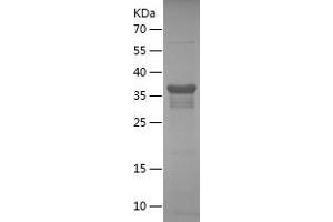 Western Blotting (WB) image for Cyclin A2 (CCNA2) (AA 144-264) protein (His-IF2DI Tag) (ABIN7122519) (Cyclin A Protein (AA 144-264) (His-IF2DI Tag))