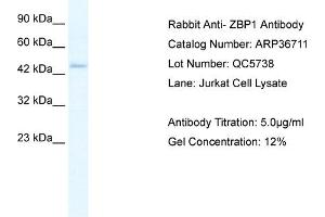 WB Suggested Anti-ZBP1 Antibody Titration: 5. (ZBP1 antibody  (Middle Region))