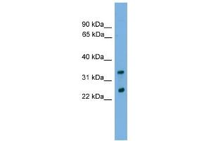 WB Suggested Anti-CHMP4B Antibody Titration: 0. (CHMP4B antibody  (Middle Region))