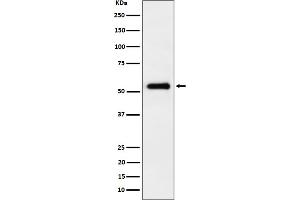 Western blot analysis of PRD expression in HepG2 cell lysate. (Recombinant Primary Retinal Dysplasia (PRD) antibody)