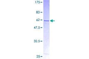 Image no. 1 for Annexin A10 (ANXA10) (AA 1-324) protein (GST tag) (ABIN1345172) (Annexin a10 Protein (AA 1-324) (GST tag))