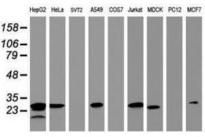 Image no. 3 for anti-Hydroxysteroid (17-Beta) Dehydrogenase 8 (HSD17B8) (AA 57-261) antibody (ABIN1491596) (HSD17B8 antibody  (AA 57-261))