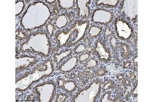 IHC analysis of SCA2/ATXN2 using anti-SCA2/ATXN2 antibody (ABIN7599900). (Ataxin 2 antibody  (AA 1278-1313))