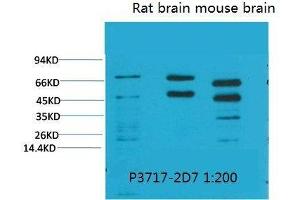 Western Blot (WB) analysis of 1) HeLa, 2)Rat Brain Tissue, 3) Mouse Brain Tissue with Phosphoserine Mouse Monoclonal Antibody diluted at 1:2000. (Phosphoserine antibody  (phosphorylated))