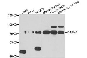 Western blot analysis of extracts of various cell lines, using CAPN5 antibody. (Calpain 5 antibody  (AA 361-640))