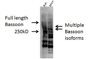 Western blot analysis of Mouse, Rat brain cell lysates showing detection of Bassoon protein using Rabbit Anti-Bassoon Polyclonal Antibody . (Bassoon antibody  (AA 786-1041) (PerCP))