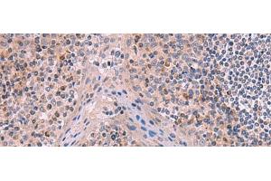 Immunohistochemistry of paraffin-embedded Human tonsil tissue using ITIH4 Polyclonal Antibody at dilution of 1:50(x200) (ITIH4 antibody)