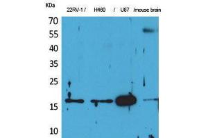 Western Blot (WB) analysis of 22RV-1, H460, U87, Mouse Brain cells using Apelin Polyclonal Antibody. (Apelin antibody  (C-Term))