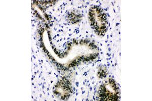 Immunohistochemistry (IHC) image for anti-X-Ray Repair Complementing Defective Repair in Chinese Hamster Cells 1 (XRCC1) (AA 15-34), (N-Term) antibody (ABIN3044234)