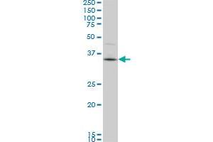 Western Blotting (WB) image for anti-PDZ Binding Kinase (PBK) (AA 1-110) antibody (ABIN599273) (PBK antibody  (AA 1-110))