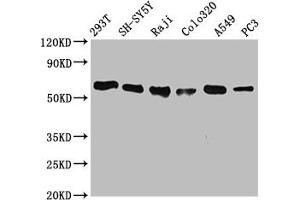 Western Blot Positive WB detected in: 293T whole cell lysate, SH-SY5Y whole cell lysate, Raji whole cell lysate, Colo320 whole cell lysate, A549 whole cell lysate, PC3 whole cell lysate All lanes: FTO antibody at 0. (Recombinant FTO antibody)