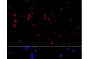 Immunofluorescence analysis of PC-12 cells using TBP Polyclonal Antibody at dilution of 1:100 (40x lens). (TBP antibody)