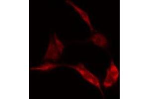 ABIN6278151 staining  Hela cells by IF/ICC. (LGALS1/Galectin 1 antibody)