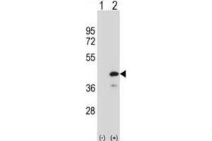 Western Blotting (WB) image for anti-Protein tyrosine Phosphatase, Non-Receptor Type 18 (Brain-Derived) (PTPN18) antibody (ABIN2999086)