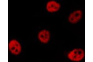 ABIN6277000 staining  Hela cells by IF/ICC. (PSMC3 antibody)