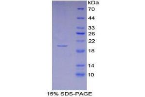 SDS-PAGE (SDS) image for Interferon, alpha 4 (IFNa4) (AA 26-186) protein (His tag) (ABIN1170719) (IFNA4 Protein (AA 26-186) (His tag))