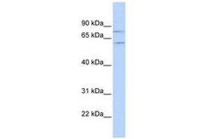 Image no. 1 for anti-Protein Inhibitor of Activated STAT, 1 (PIAS1) (N-Term) antibody (ABIN6742834)